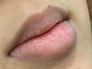 Vì sao không nên chọn tone hồng baby khi môi còn nền thâm?