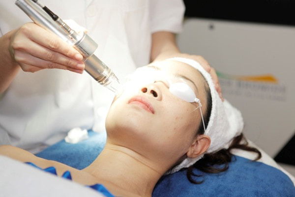 Chăm sóc da sau khi tẩy nốt ruồi bằng laser CO2 1 Tẩy nốt ruồi bằng laser giúp loại bỏ nốt ruồi một cách hiệu quả