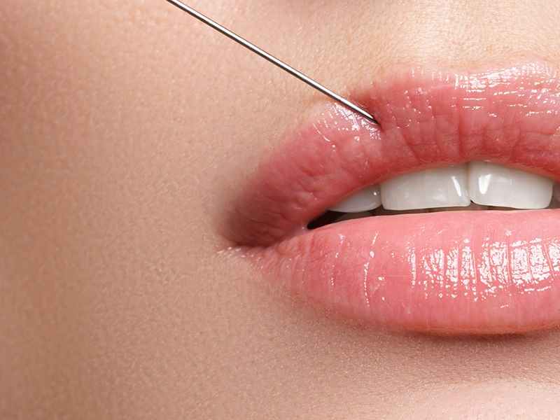 clinic lips cover e89cc06dbb