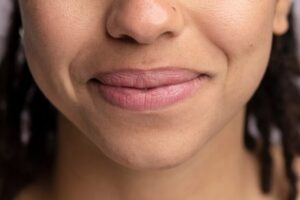 Vì sao khử thâm môi không lên màu?