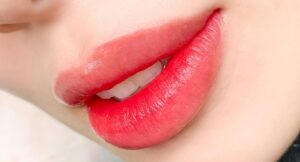 Sau khử thâm môi có bị nhạy cảm với ánh nắng không?