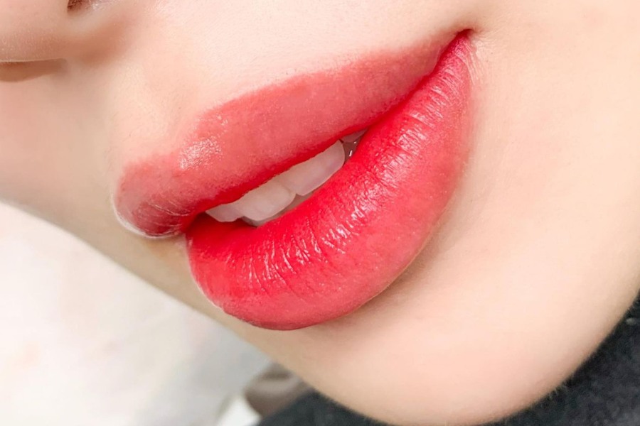 Sau khử thâm môi có bị nhạy cảm với ánh nắng không?