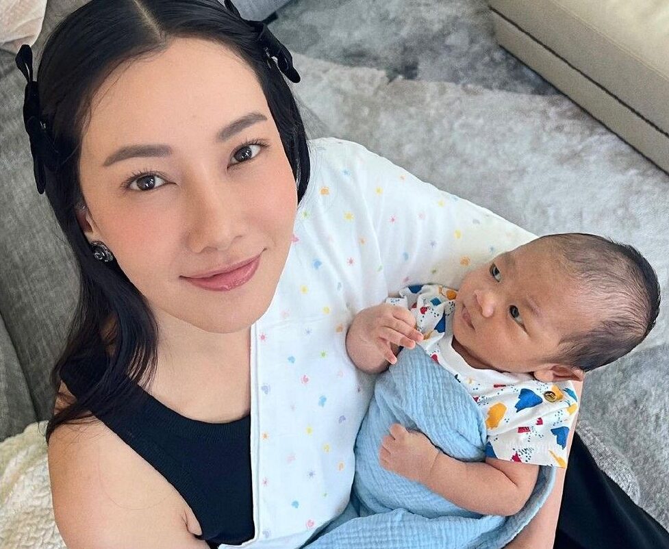 Vì sao phụ nữ sau sinh nên chọn phun môi hơn tiêm filler?