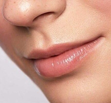 Cấu trúc da môi mỏng có ảnh hưởng đến hiệu quả khử thâm không?