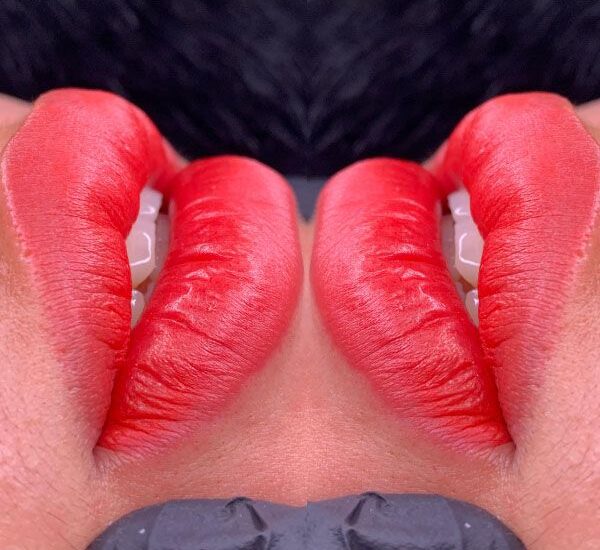 Da môi nhạy cảm có nên phun môi collagen? 1 Da môi nhạy cảm có nên phun môi collagen?