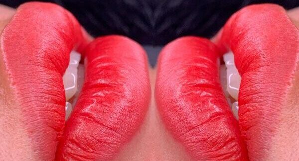 Da môi nhạy cảm có nên phun môi collagen?