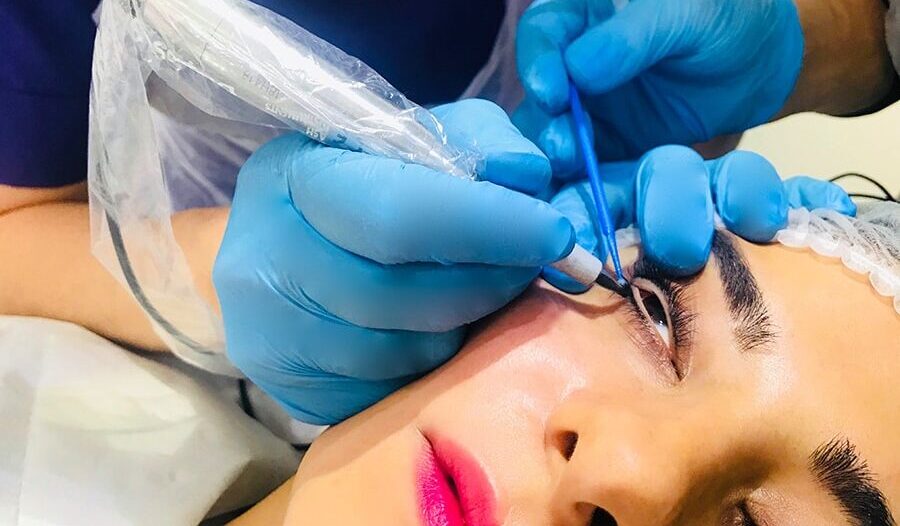 Mí phun xong bị căng da mí, mở mắt khó – cách xử lý?