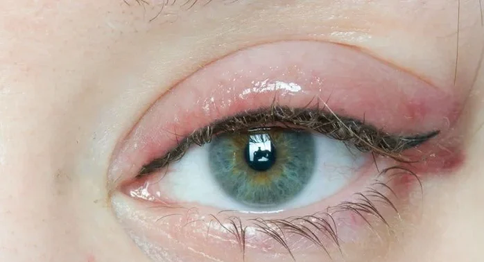 eyestattoohealingprocess 1 e1764126566657