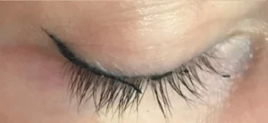 Phun mí bong từng mảng nhỏ có phải bị lỗi không?