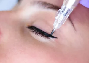 Vì sao nhiều người chọn phun mí sau khi cắt mí?