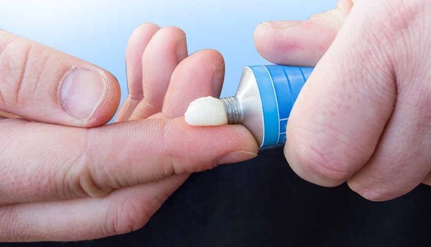 Mí phun xong có nên bôi thuốc mỡ kháng sinh không?