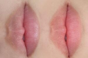 hut tham moi gia bao nhieu tuy vao tinh trang tham cua moi ma muc gia khu tham se khac nhau