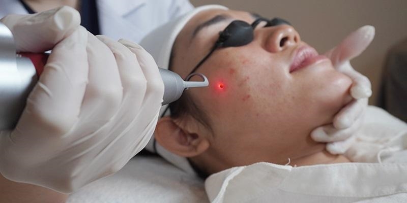 Tẩy nốt ruồi có được ăn cá không? Tẩy nốt ruồi có được ăn cá không?