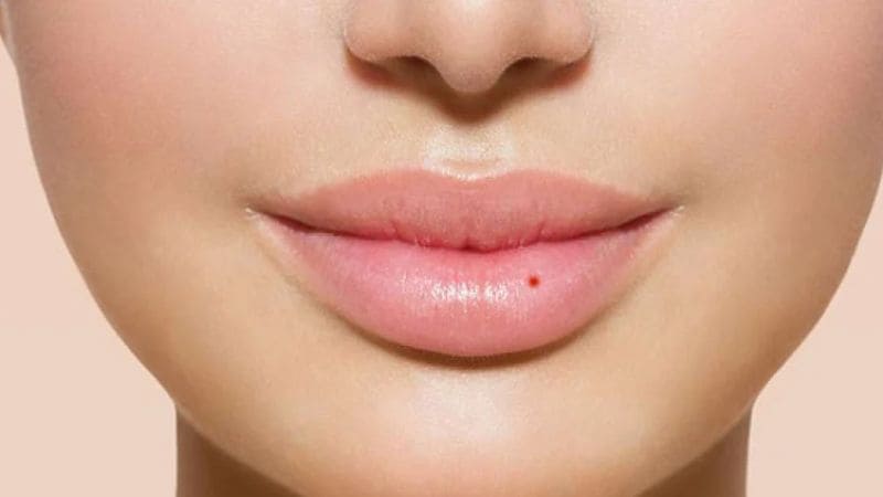 Các công nghệ xăm nốt ruồi son hiện đại 1 Xăm nốt ruồi son là gì?