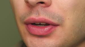 Môi nam bị loang màu sau khử là do đâu? Cách khắc phục hiệu quả nhất 1 Môi nam bị loang màu sau khử là do đâu?