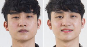 Phun mày cho nam giới: Xu hướng mới giúp gương mặt nam tính hơn