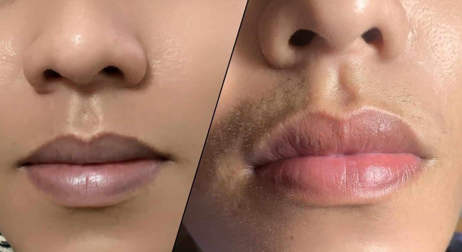 Khi đàn ông bắt đầu quan tâm đến khử thâm môi 5 khu tham moi nam nu hai phong 2 1536x1536 1 e1761103720434