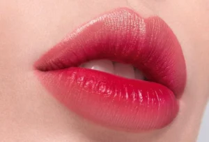 Khử thâm môi là gì?