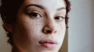 lam sao de phan biet tan nhang va not ruoi 1 03b677805a