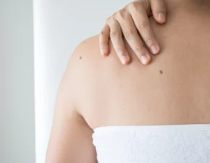 lam sao tay not ruoi bang kem danh rang 1 febc974081