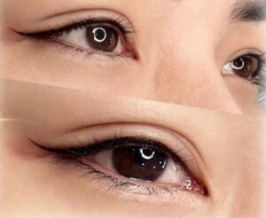 Có phải người hướng nội thường chọn phun mí tự nhiên?