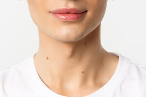 Khử thâm môi nam bao lâu thì hồi phục hoàn toàn?