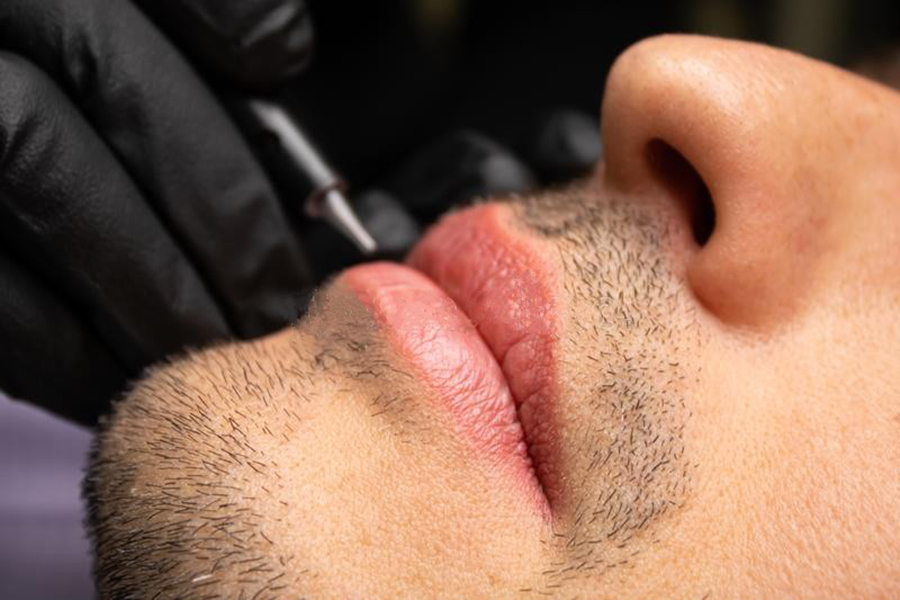 So sánh khử thâm môi nam công nghệ Nano và Laser – đâu hiệu quả hơn? 1 Khử thâm môi nam là gì?