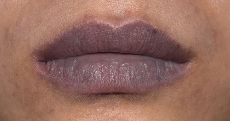 Cách nhận biết da môi yếu – dấu hiệu cấm phun khử thâm môi vội 2 moi tham 2 e1761206091765