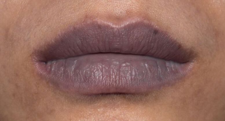 moi tham 2 e1764144113965