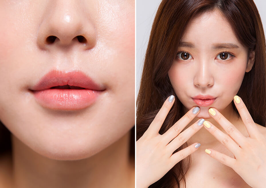 Filler môi có bị tan không?