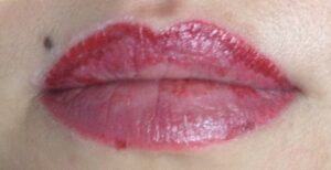 Top lỗi phun xăm dễ phải sửa nhất trong năm 2026 2 Môi khử xong bị bong sớm – dấu hiệu da yếu hay lỗi kỹ thuật?