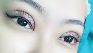 Có nên phun mí khi đã cắt mí hoặc nhấn mí?