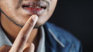 Khi đàn ông bắt đầu quan tâm đến khử thâm môi