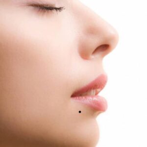 not ruoi duoi mieng ben phai so 1