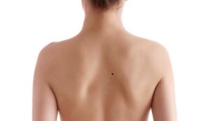 Có nên xăm nốt ruồi ở lưng không?