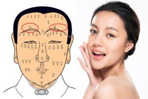 Ý nghĩa phong thủy của nốt ruồi ở trán