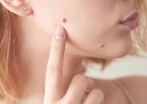 Xăm nốt ruồi son ở má trái là gì?