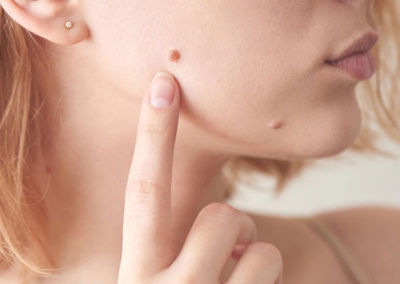 Xăm nốt ruồi son ở má trái – ý nghĩa phong thủy và thẩm mỹ 1 Xăm nốt ruồi son ở má trái là gì?