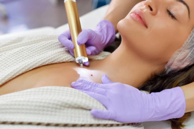 Có nên xóa/xử lý lại nốt ruồi son đã xăm bị hỏng hay không? 3 Thực hiện xăm nốt ruồi