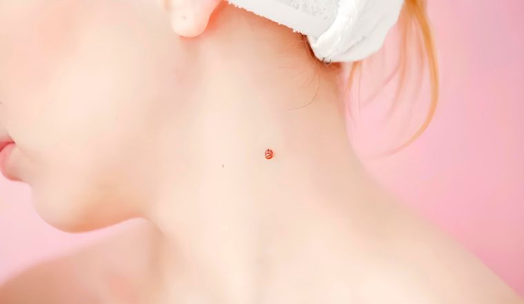 Xăm nốt ruồi son là gì? Xăm nốt ruồi son là gì?