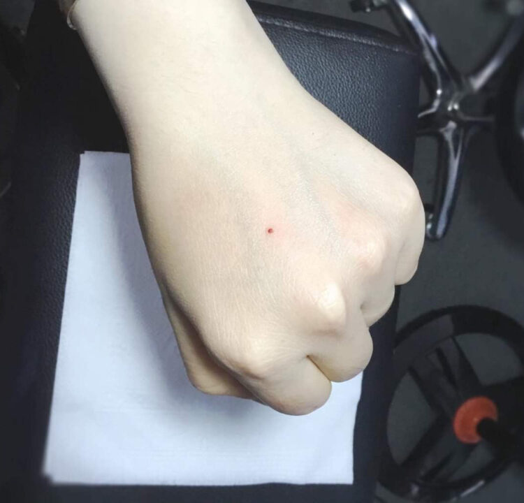 Xăm nốt ruồi son bao lâu thì bong và lên màu đẹp tự nhiên?