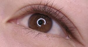 kỹ thuật mí ẩn