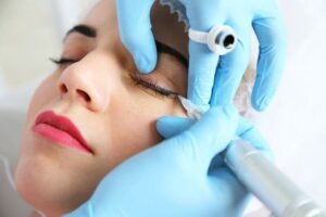 Sau phun mí thấy châm chích như kim đâm – do cơ địa hay kỹ thuật?