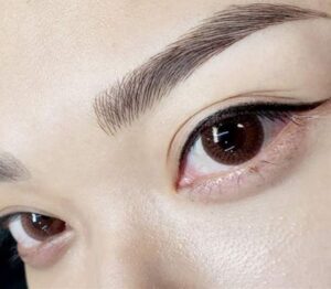 Phun mí có ảnh hưởng đến tuyến lệ không?