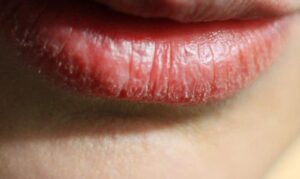 phun moi bi bong da nhieu lan 1