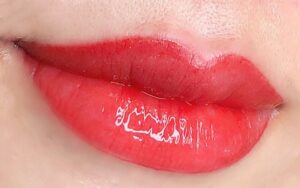 phun moi collagen can kieng gi 3 1