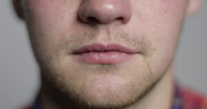 phun moi khu tham cho nam co hieu qua khong 4 1