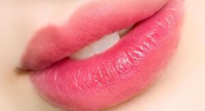 Cách phục hồi da môi khô nứt sau khi khử thâm