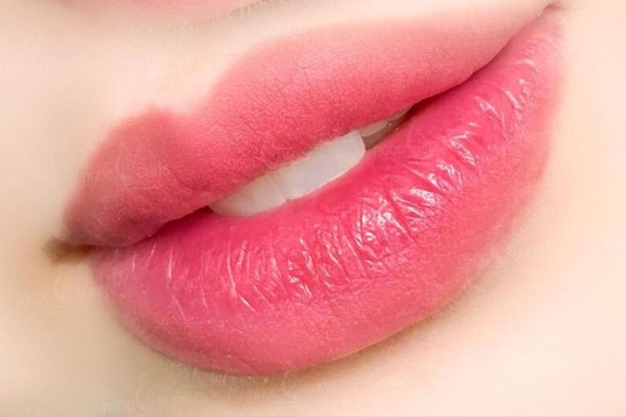 Cách phục hồi da môi khô nứt sau khi khử thâm