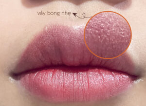 sau 1 2 ngay moi bong vay nhe e1760776841543